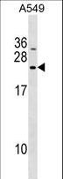 DNAJC5B Antibody - DNAJC5B Antibody western blot of A549 cell line lysates (35 ug/lane). The DNAJC5B antibody detected the DNAJC5B protein (arrow).