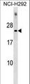 DNAJC5G Antibody - DNAJC5G Antibody western blot of NCI-H292 cell line lysates (35 ug/lane). The DNAJC5G antibody detected the DNAJC5G protein (arrow).