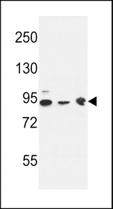 DNAJC6 Antibody - DNAJC6 Antibody western blot of K562(lane 1),HL-60 cell line(lane 2) and mouse brain tissue(lane 3) lysates (35 ug/lane). The DNAJC6 antibody detected the DNAJC6 protein (arrow).