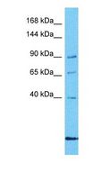 DNAJC6 Antibody - Western blot of DNAJC6 Antibody with human MDA-MB-435s Whole Cell lysate.  This image was taken for the unconjugated form of this product. Other forms have not been tested.