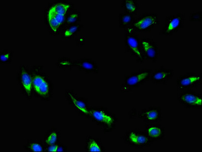 DNAJC6 Antibody - Immunofluorescent analysis of Hela cells using DNAJC6 Antibody at dilution of 1:100 and Alexa Fluor 488-congugated AffiniPure Goat Anti-Rabbit IgG(H+L)