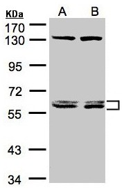 DNAJC7 Antibody - Sample (30 ug of whole cell lysate). A:293T, B: A431. 7.5% SDS PAGE. DNAJC7 antibody diluted at 1:1500