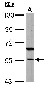 DNAJC7 Antibody - Sample (50 ug of whole cell lysate). A: Mouse brain. 7.5% SDS PAGE. DNAJC7 antibody diluted at 1:1000.