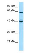 DNAJC7 Antibody - DNAJC7 antibody Western Blot of HepG2.  This image was taken for the unconjugated form of this product. Other forms have not been tested.