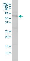 DNAJC7 Antibody - DNAJC7 monoclonal antibody (M01), clone 4G6-G3 Western Blot analysis of DNAJC7 expression in HeLa.