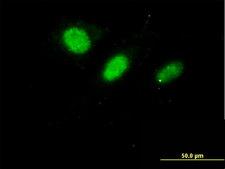 DNAJC7 Antibody - Immunofluorescence of monoclonal antibody to DNAJC7 on HeLa cell. [antibody concentration 10 ug/ml]