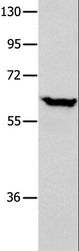 DNAJC7 Antibody - Western blot analysis of Human seminoma tissue, using DNAJC7 Polyclonal Antibody at dilution of 1:400.