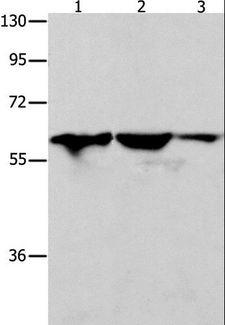 DNAJC7 Antibody - Western blot analysis of Human seminoma tissue, HT-29 and A549 cell, using DNAJC7 Polyclonal Antibody at dilution of 1:400.