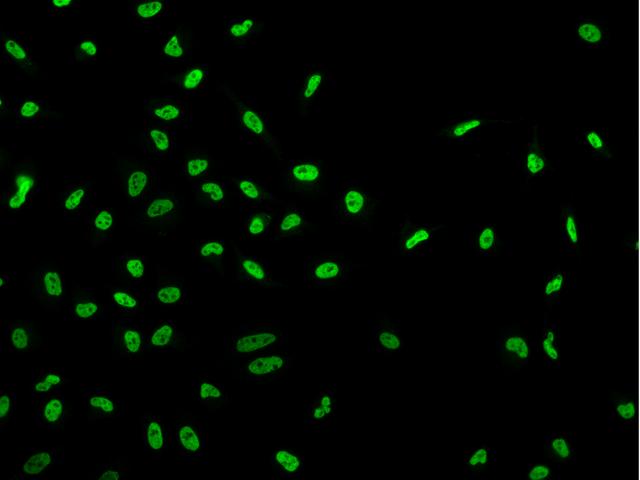 DNAJC8 Antibody - Immunofluorescence staining of DNAJC8 in HeLa cells. Cells were fixed with 4% PFA, permeabilzed with 0.1% Triton X-100 in PBS, blocked with 10% serum, and incubated with rabbit anti-Human DNAJC8 polyclonal antibody (dilution ratio 1:200) at 4°C overnight. Then cells were stained with the Alexa Fluor 488-conjugated Goat Anti-rabbit IgG secondary antibody (green). Positive staining was localized to Nucleus.
