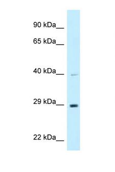 DNAJC9 Antibody - DNAJC9 antibody Western blot of 721_B Cell lysate. Antibody concentration 1 ug/ml.  This image was taken for the unconjugated form of this product. Other forms have not been tested.