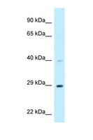 DNAJC9 Antibody - DNAJC9 antibody Western blot of 721_B Cell lysate. Antibody concentration 1 ug/ml.  This image was taken for the unconjugated form of this product. Other forms have not been tested.