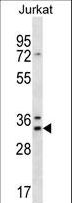 DNAJC9 Antibody - DNAJC9 Antibody western blot of Jurkat cell line lysates (35 ug/lane). The DNAJC9 antibody detected the DNAJC9 protein (arrow).