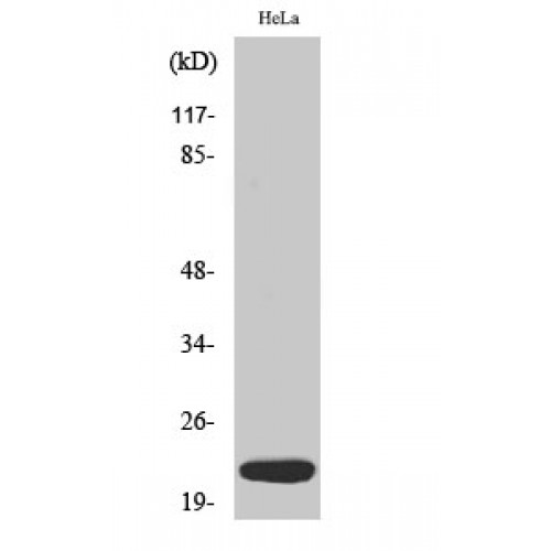 DNAL1 Antibody - Western blot of Dynein LC 1 antibody