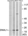 DNAL1 Antibody - Western blot analysis of lysates from HeLa, HepG2, and MCF-7 cells, using DNAL1 Antibody. The lane on the right is blocked with the synthesized peptide.