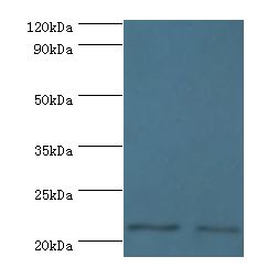 DNAL1 Antibody - Western blot. All lanes: DNAL1 antibody at 4 ug/ml. Lane 1: HeLa whole cell lysate. Lane 2: HepG2 whole cell lysate. Secondary antibody: Goat polyclonal to rabbit at 1:10000 dilution. Predicted band size: 22 kDa. Observed band size: 22 kDa.