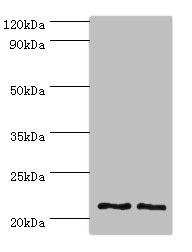 DNAL1 Antibody - Western blot All lanes: DNAL1 antibody at 4µg/ml Lane 1: Hela whole cell lysate Lane 2: HepG2 whole cell lysate Secondary Goat polyclonal to rabbit IgG at 1/10000 dilution Predicted band size: 22, 9, 18 kDa Observed band size: 22 kDa