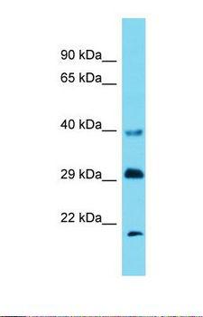 DNAL1 Antibody - Western blot of Mouse Liver. Dnalc1 antibody dilution 1.0 ug/ml.  This image was taken for the unconjugated form of this product. Other forms have not been tested.