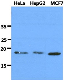 DNAL1 Antibody - The cell lysates of HeLa, HepG2 and MCF7 (40ug) were resolved by SDS-PAGE, transferred to PVDF membrane and probed with anti-human DNAL1 antibody (1:1000). Proteins were visualized using a goat anti-mouse secondary antibody conjugated to HRP and an ECL detection system.