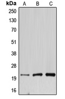 DNAL1 Antibody - Western blot analysis of DNAL1 expression in HEK293T (A); mouse testis (B); rat kidney (C) whole cell lysates.