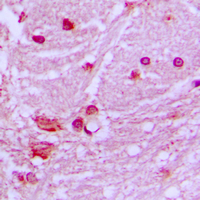 DNAL1 Antibody - Immunohistochemical analysis of DNAL1 staining in human brain formalin fixed paraffin embedded tissue section. The section was pre-treated using heat mediated antigen retrieval with sodium citrate buffer (pH 6.0). The section was then incubated with the antibody at room temperature and detected using an HRP conjugated compact polymer system. DAB was used as the chromogen. The section was then counterstained with hematoxylin and mounted with DPX.