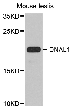 DNAL1 Antibody - Western blot analysis of extract of various cells.