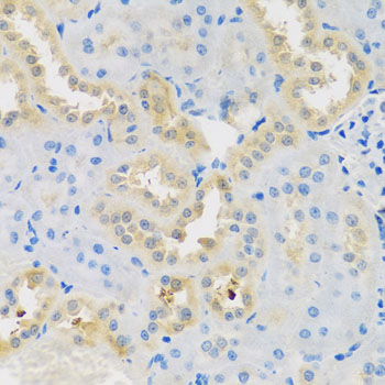 DNAL1 Antibody - Immunohistochemistry of paraffin-embedded rat kidney tissue.