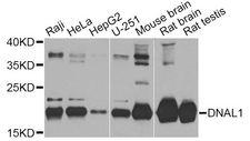 DNAL1 Antibody - Western blot analysis of extracts of various cell lines, using DNAL1 Antibody at 1:1000 dilution. The secondary antibody used was an HRP Goat Anti-Rabbit IgG (H+L) at 1:10000 dilution. Lysates were loaded 25ug per lane and 3% nonfat dry milk in TBST was used for blocking. An ECL Kit was used for detection and the exposure time was 30s.
