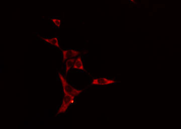 DNAL1 Antibody - Staining HeLa cells by IF/ICC. The samples were fixed with PFA and permeabilized in 0.1% Triton X-100, then blocked in 10% serum for 45 min at 25°C. The primary antibody was diluted at 1:200 and incubated with the sample for 1 hour at 37°C. An Alexa Fluor 594 conjugated goat anti-rabbit IgG (H+L) antibody, diluted at 1/600, was used as secondary antibody.