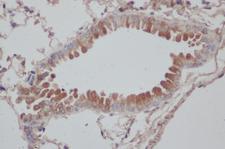 DNAL1 Antibody - Immunohistochemistry of paraffin-embedded Rat lung using DNAL1 Polyclonal Antibody at dilution of 1:50.