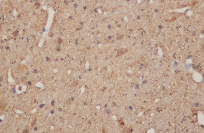 DNAL1 Antibody - Immunohistochemistry of paraffin-embedded Mouse brain using DNAL1 Polyclonal Antibody at dilution of 1:50.