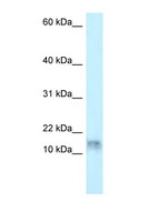 DNAL1 Antibody - DNAL1 antibody Western blot of HepG2 Cell lysate. Antibody concentration 1 ug/ml.  This image was taken for the unconjugated form of this product. Other forms have not been tested.