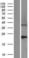 DNAL1 Protein - Western validation with an anti-DDK antibody * L: Control HEK293 lysate R: Over-expression lysate