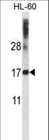 DNAL4 / Dynein Light Chain 4 Antibody - DNAL4 Antibody western blot of HL-60 cell line lysates (35 ug/lane). The DNAL4 antibody detected the DNAL4 protein (arrow).