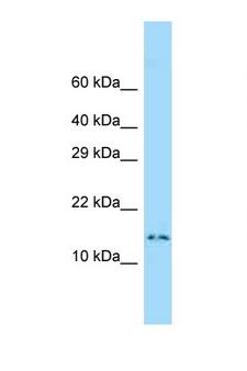 DNAL4 / Dynein Light Chain 4 Antibody - DNAL4 antibody Western blot of Small Intestine lysate. Antibody concentration 1 ug/ml.  This image was taken for the unconjugated form of this product. Other forms have not been tested.