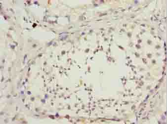 DNAL4 / Dynein Light Chain 4 Antibody - Immunohistochemistry of paraffin-embedded human testis tissue using antibody at dilution of 1:100.