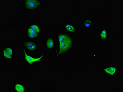 DNAL4 / Dynein Light Chain 4 Antibody - Immunofluorescent analysis of MCF-7 cells using DNAL4 Antibody at dilution of 1:100 and Alexa Fluor 488-congugated AffiniPure Goat Anti-Rabbit IgG(H+L)