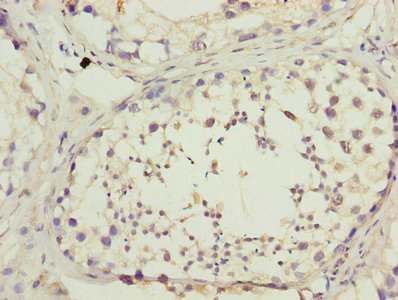 DNAL4 / Dynein Light Chain 4 Antibody - Immunohistochemistry of paraffin-embedded human testis tissue using DNAL4 Antibody at dilution of 1:100
