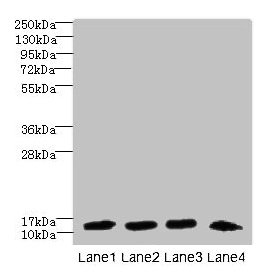 DNAL4 / Dynein Light Chain 4 Antibody - Western blot All lanes: DNAL4 antibody at 1.5µg/ml Lane 1: Mouse gonadal tissue Lane 2: HL60 whole cell lysate Lane 3: NIH/3T3 whole cell lysate Lane 4: Mouse brain tissue Secondary Goat polyclonal to rabbit IgG at 1/10000 dilution Predicted band size: 12 kDa Observed band size: 12 kDa