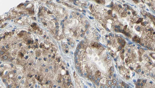 DNAL4 / Dynein Light Chain 4 Antibody - 1:100 staining human prostate tissue by IHC-P. The sample was formaldehyde fixed and a heat mediated antigen retrieval step in citrate buffer was performed. The sample was then blocked and incubated with the antibody for 1.5 hours at 22°C. An HRP conjugated goat anti-rabbit antibody was used as the secondary.