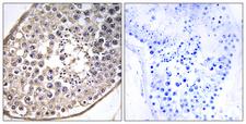 DNAL4 / Dynein Light Chain 4 Antibody - Peptide - + Immunohistochemistry analysis of paraffin-embedded human testis tissue using DNAL4 antibody.