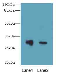 DNALI1 Antibody - Western blot. All lanes: DNALI1 antibody at 1 ug/ml. Lane 1: Mouse gonadal tissue. Lane 2: Mouse lung tissue. Secondary Goat polyclonal to Rabbit IgG at 1:10000 dilution. Predicted band size: 30 kDa. Observed band size: 30 kDa.