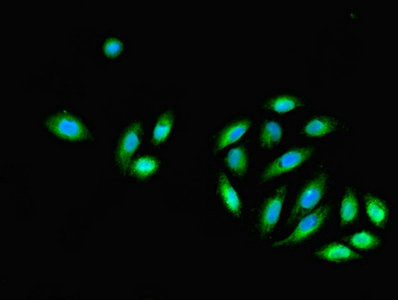 DNALI1 Antibody - Immunofluorescent analysis of A549 cells using DNALI1 Antibody at dilution of 1:100 and Alexa Fluor 488-congugated AffiniPure Goat Anti-Rabbit IgG(H+L)
