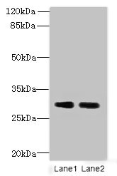 DNALI1 Antibody - Western blot All lanes: DNALI1 antibody at 1µg/ml Lane 1: Mouse gonadal tissue Lane 2: Mouse lung tissue Secondary Goat polyclonal to rabbit IgG at 1/10000 dilution Predicted band size: 30, 16 kDa Observed band size: 30 kDa