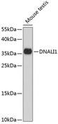 DNALI1 Antibody - Western blot analysis of extracts of mouse testis using DNALI1 Polyclonal Antibody at dilution of 1:1000.