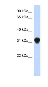 DNALI1 Antibody - DNALI1 antibody Western blot of Transfected 293T cell lysate. This image was taken for the unconjugated form of this product. Other forms have not been tested.