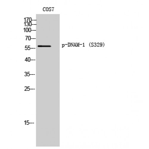 DNAM-1 / CD226 Antibody - Western blot of Phospho-DNAM-1 (S329) antibody