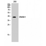 DNAM-1 / CD226 Antibody - Western blot of DNAM-1 antibody