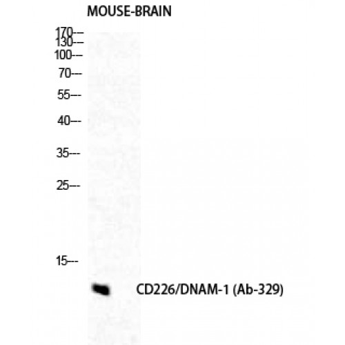 DNAM-1 / CD226 Antibody - Western blot of DNAM-1 antibody