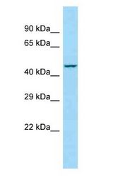 DNAM-1 / CD226 Antibody - DNAM-1 / CD226 antibody Western Blot of RPMI-8226.  This image was taken for the unconjugated form of this product. Other forms have not been tested.