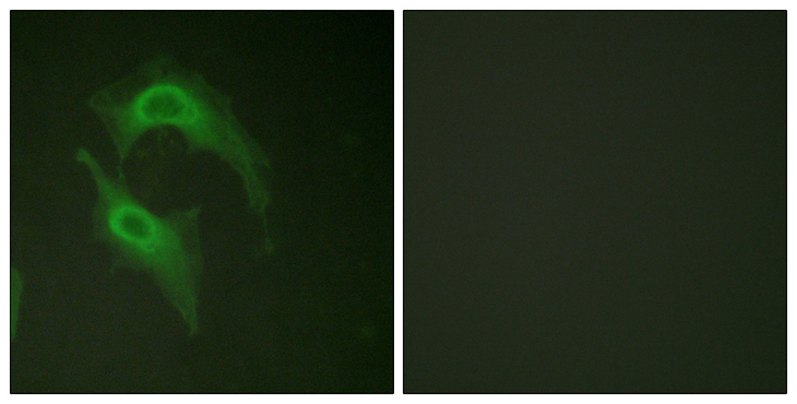 DNAM-1 / CD226 Antibody - Immunofluorescence analysis of HeLa cells, using CD226/DNAM-1 Antibody. The picture on the right is blocked with the synthesized peptide.